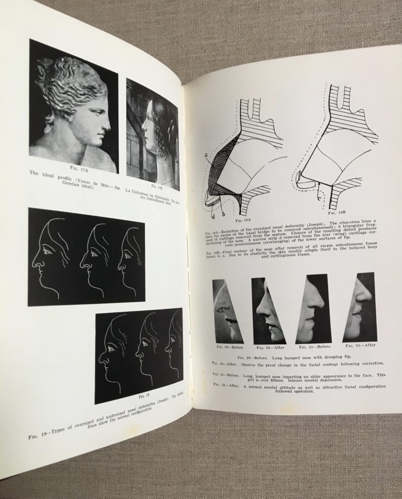 Early Plastic Surgery Book by WWI Allied Surgeon Jacques Maliniak - Image 8
